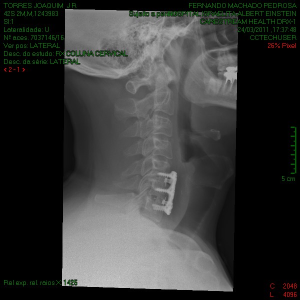 x ray side view